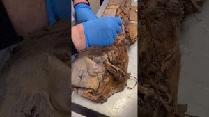 Топографическая Анатомия: обнажение бедренной артерии