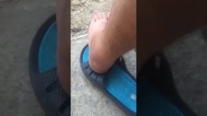 ?Перелом пятки без смещения,3 месяца спустя...