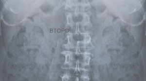 #14 Бальзам для позвоночника. Станислав Лосев_ Отказ от желания радоваться жизни