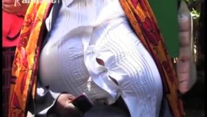 Cemania na Beatrice uria ukoretwo na murimu wa Gigantomastia kwa ihinda ria miaka 12