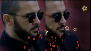 что случилось с глазом Ислам итляшев срочно слушаем и смотрим