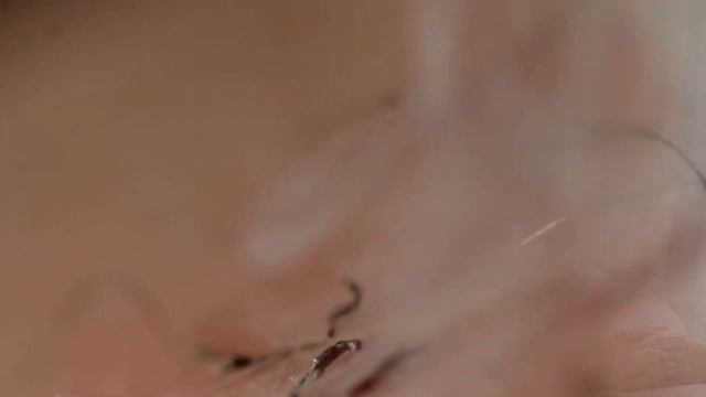 Лазерная эпиляция в питере - незаменимая процедура. смотреть онлайн