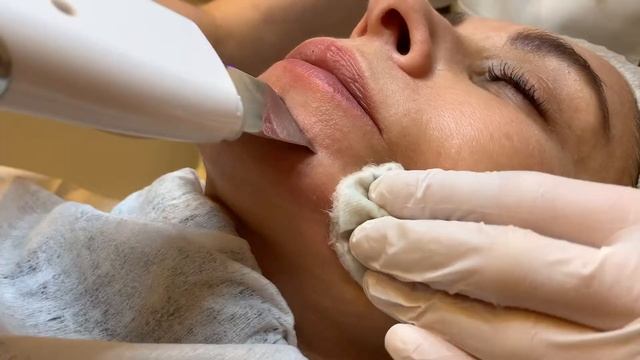 Ультразвуковая чистка лица смотреть онлайн