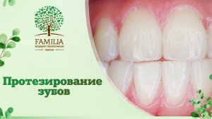 ? Протезирование зубов