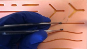 Шов Альговера