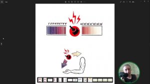 В этом видео я рассказываю  о прогнозе пациента после спинальной травмы. ASIA\полная\неполная.