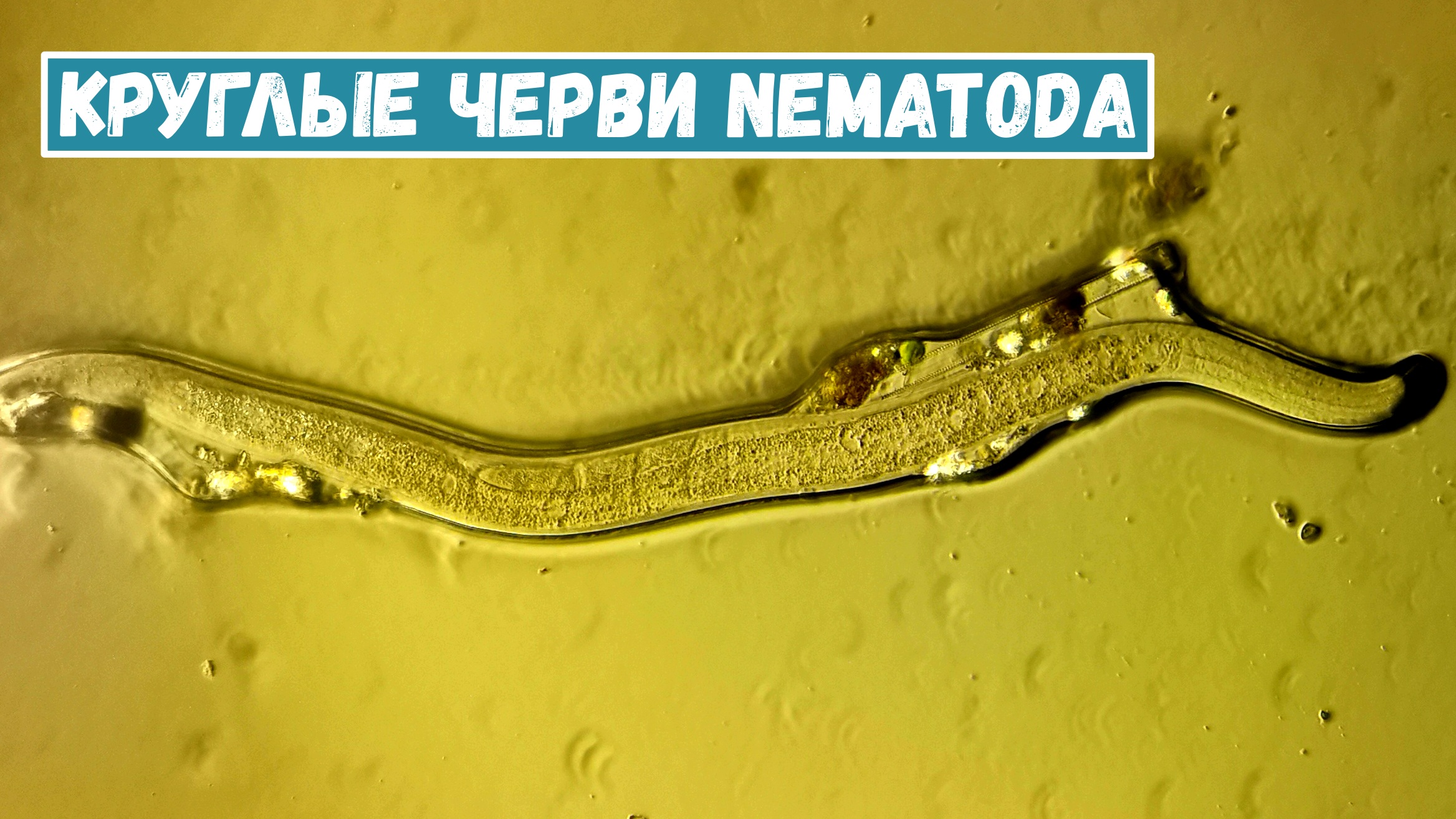 Черви Nematoda, найденные в кусочке мха