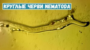 Черви Nematoda, найденные в кусочке мха