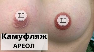 СОСКИ Камуфляж шрамов/рубцов на ареоле. Перманентный макияж ареол. Эстетическое улучшение ареол