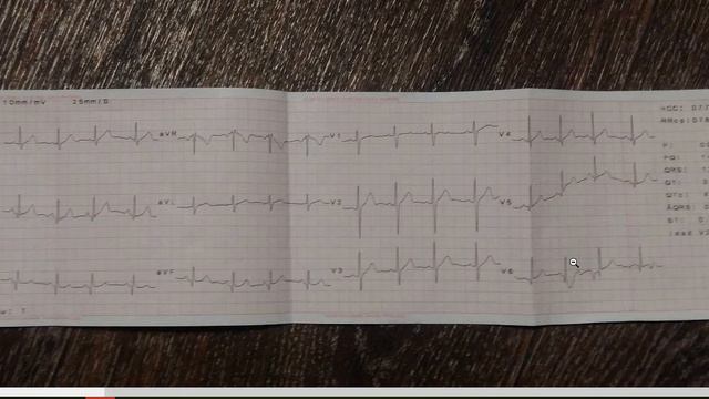 Запис 2019 04 28 08 57 19 226