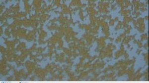 Кровь до и после выпитой воды с перекисью водорода