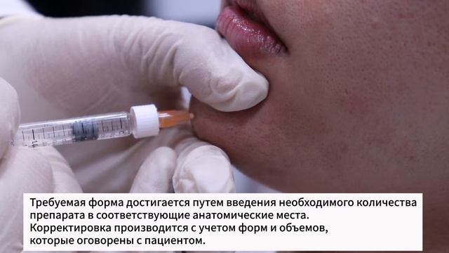 Техника инъекционной мезотерапии подбородка при помощи филлера Celosome