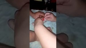 Купирование хвостов тойчиков