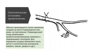 Остановка кровотечения. Оперативная хирургия.