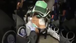 Система для сердечно-легочной реанимации