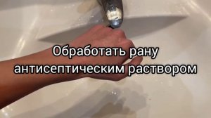 Оказание первой помощи при порезе