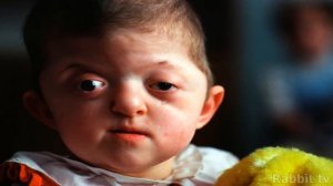 ДЕТИ  ЧЕРНОБЫЛЯ. КАКИЕ ОНИ?