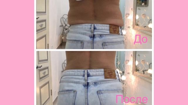 Акция на криолиполиз, скидка 60% смотреть онлайн