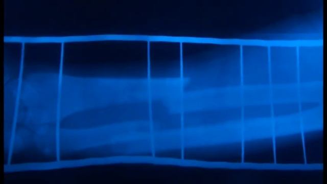 Юля Чичерина разбилась на машине смотреть онлайн