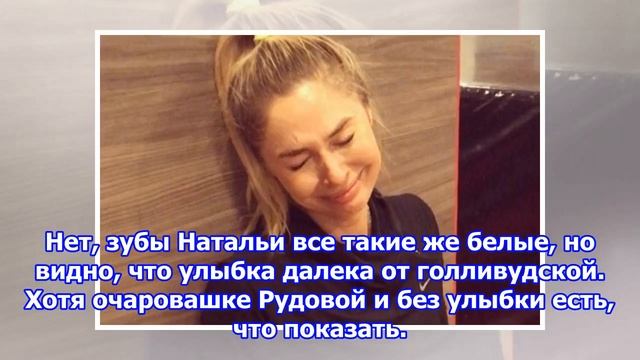 Зубы наталья рудовой оказались далеки от идеальных
