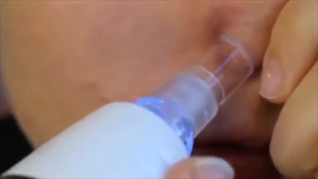 черные точки как избавиться смотреть онлайн