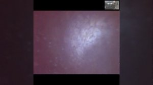 Эфект раскоксовки BMW m54