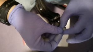 Emergency repair of rear wing in Xiaomi 365/Починить заднее крыло у самоката Xiaomi 365