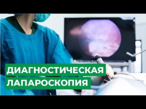 Диагностическая лапароскопия