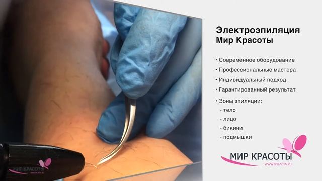 Электроэпиляция тела в Москве - Мир Красоты смотреть онлайн
