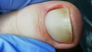 Возрастные ноги. Сложный педикюр. Бабушка первый раз на педикюре. Супер результат.