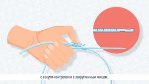 О санации дыхательных путей