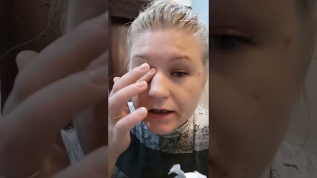 Как поднять опущенное веко в домашних условиях. смотреть онлайн
