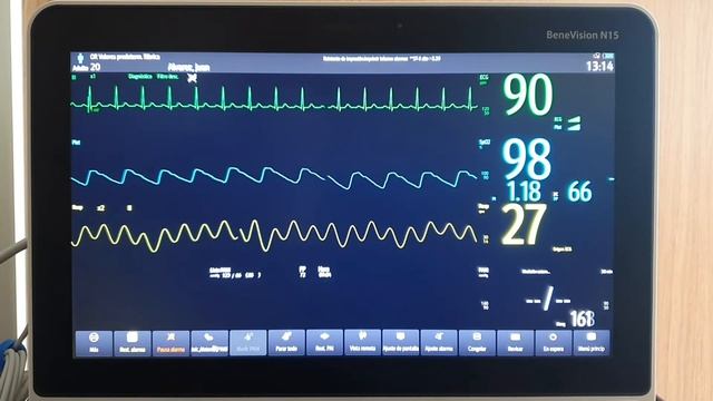 Mindray monitor de signos vitales serie Benevision N17/N15/N12. Parte 1. Operación смотреть онлайн