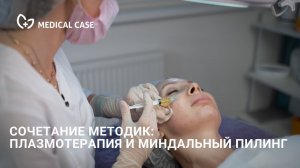 Миндальный пилинг и плазмотерапия