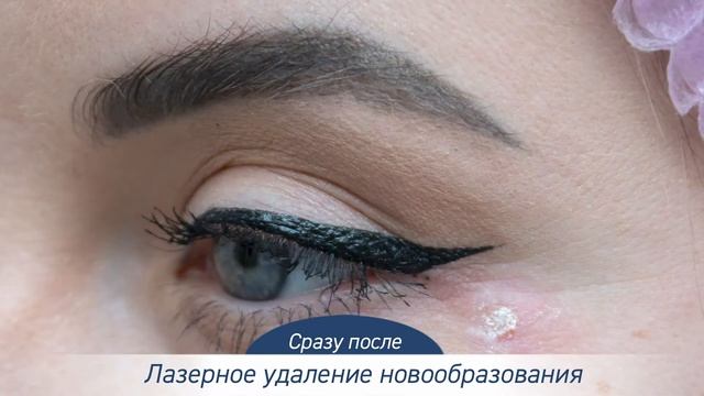 Отзыв Марии Лохман о курсе процедур в City Clinic смотреть онлайн