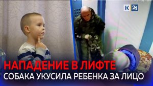 Бойцовский пес напал на ребенка в лифте