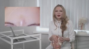 Ишемия после введения филлера в нос