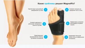 Косточка на ноге лечить