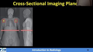 Dr. Matt Fleishman - radiologist