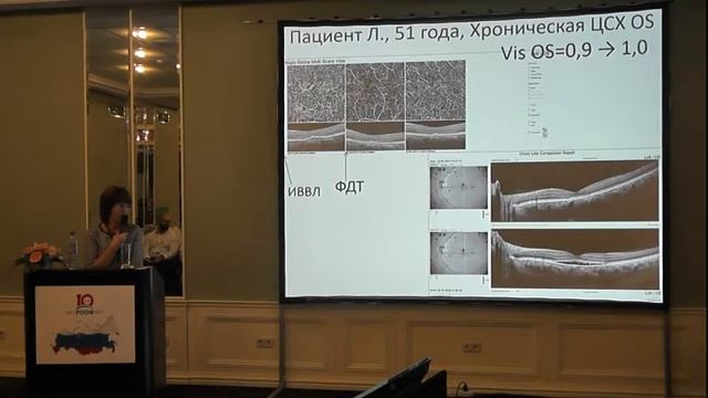 ОКТ - ангиография в диагностике и оценке эффективности фотодинамической терапии при хронической ЦСХ смотреть онлайн