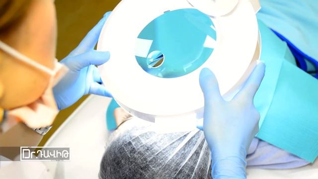 Լազերային մազահեռացում, էլեկտրոէպիլյացիա смотреть онлайн