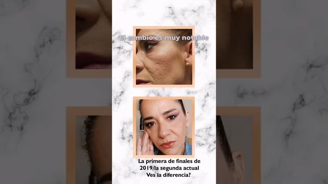 Micro-Dermoabrasion #Marykay #shorts смотреть онлайн