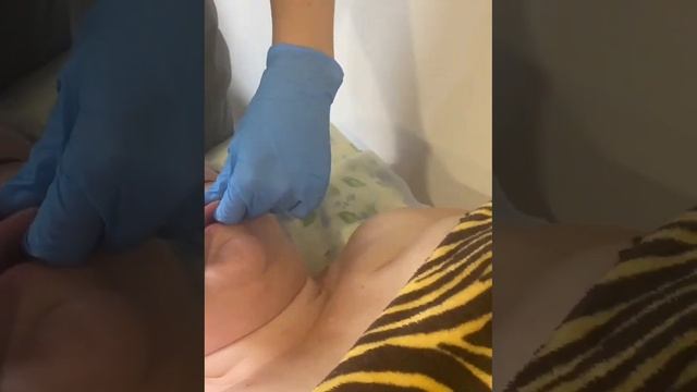 Буккальный массаж.