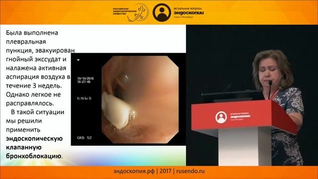 Эндоскопическая клапанная бронхоблокация при бронхоплевральном свище