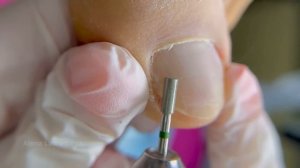 Педикюр на большой палец / Комбинированный педикюр / Средства для педикюра / #Nails #Ногти #педикюр