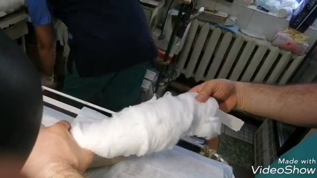 Лерник, перелом локтевой кости и сустава смотреть онлайн