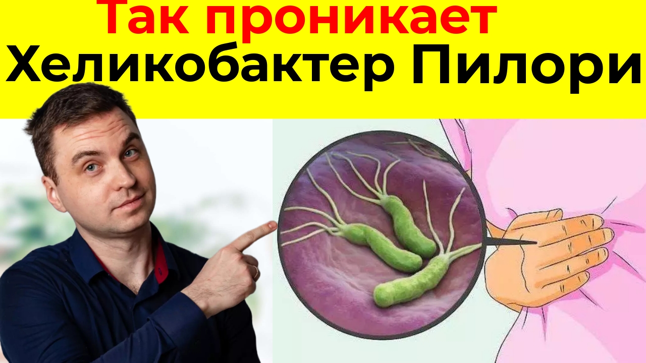 НЕ ИГНОРИРУЙТЕ эти 5 Признаков того,что у вас есть Хеликобактер Пилори. Чтобы избежать ЯЗВЫ ЖЕЛУДКА