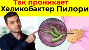 НЕ ИГНОРИРУЙТЕ эти 5 Признаков того,что у вас есть Хеликобактер Пилори. Чтобы избежать ЯЗВЫ ЖЕЛУДКА