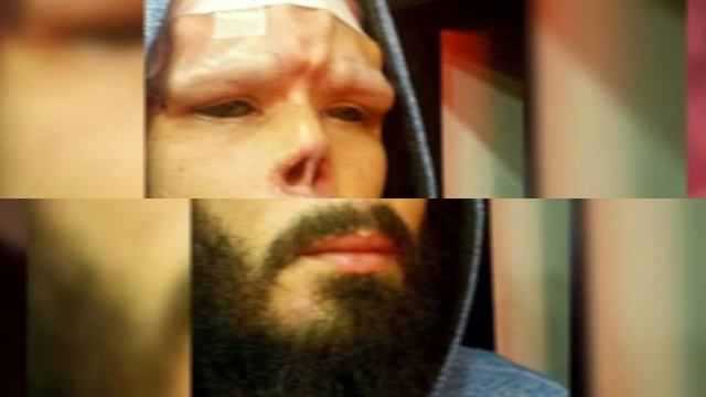 6 FEAREST AESTHETIC SURGERIES IN THE WORLD смотреть онлайн