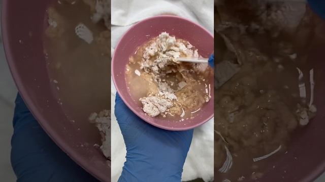 ЧИСТКА ЧЕРНЫХ ТОЧЕК смотреть онлайн